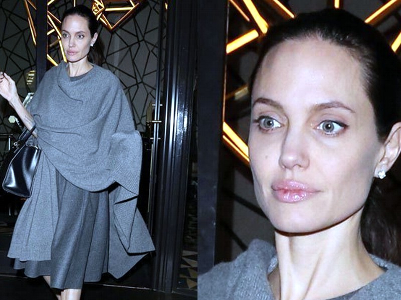 Angelina Jolie anoressica?
