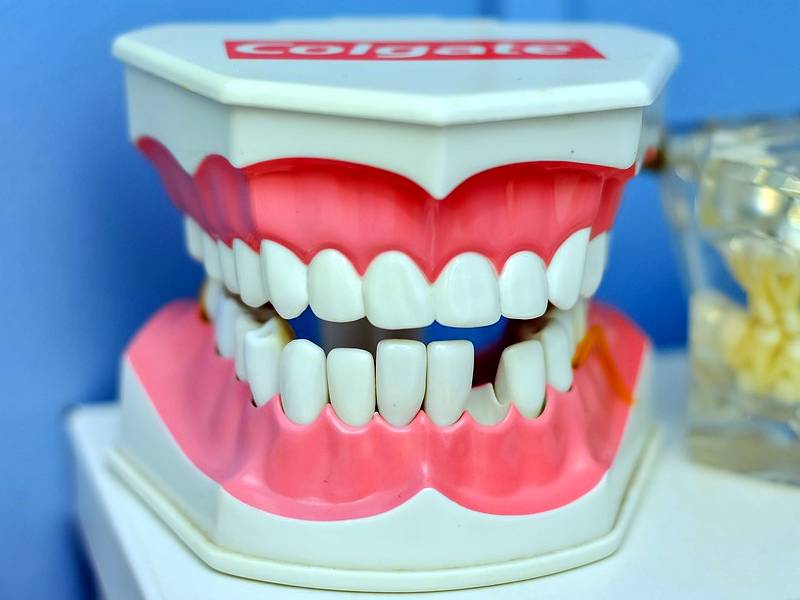 ⌛ Prevenzione e cura dei denti con i migliori ritrovati