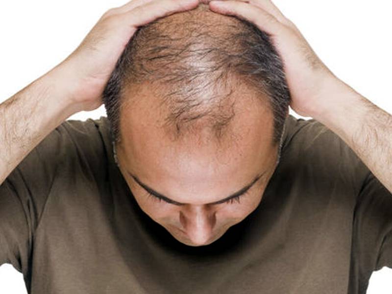 👦 Cura dei capelli e soluzione per le calvizie